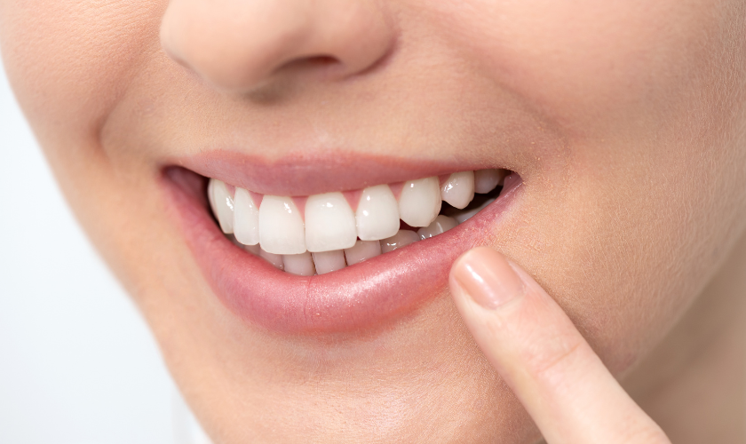 Teeth Whitening for Intrinsic Tooth Stains