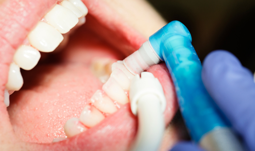 The Importance of Regular Dental Cleanings Keeping Your Smile Bright